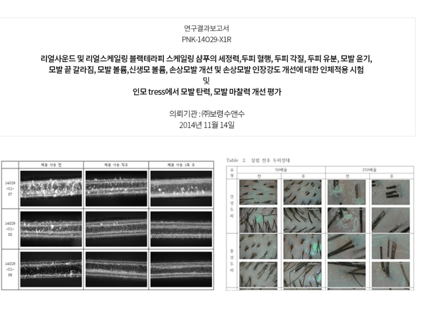 보령수앤수 인체적용시험 모발 현미경 전후 비교